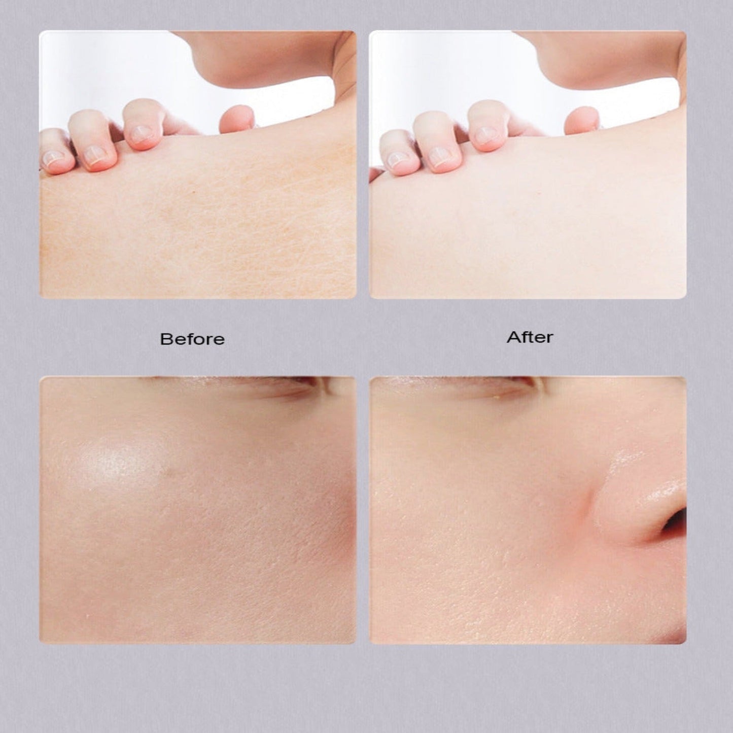 YouthBalm-Wrinkle Bounce Multi Balm™ (70% OFF TODAY)